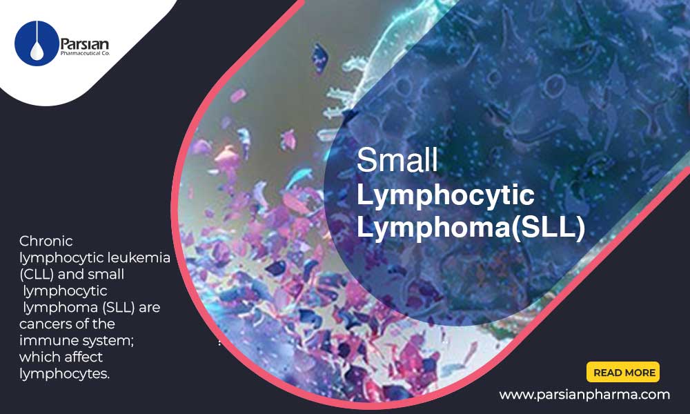Small Lymphocytic Lymphoma SLL