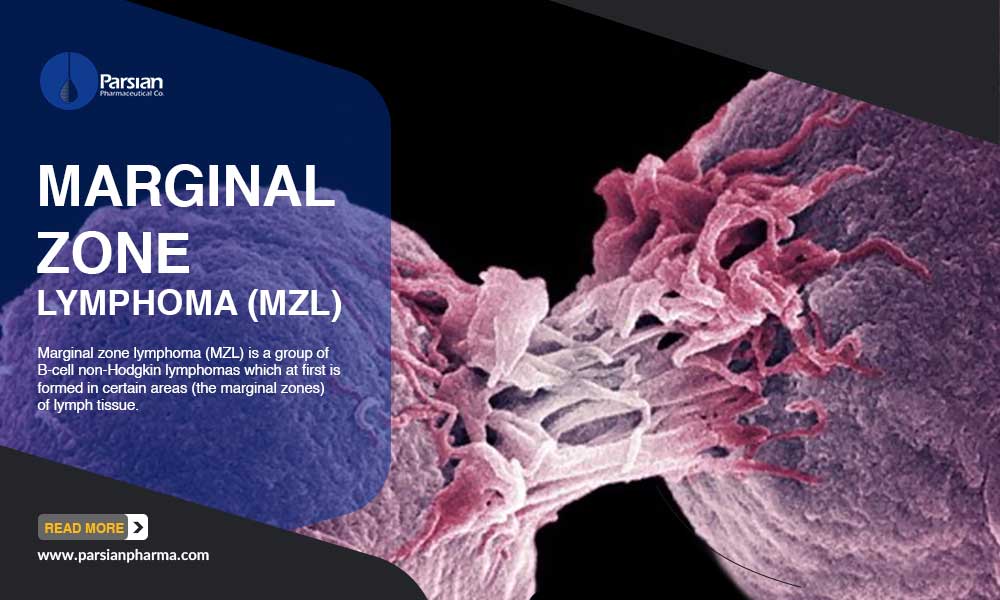 Marginal Zone Lymphoma (MZL)